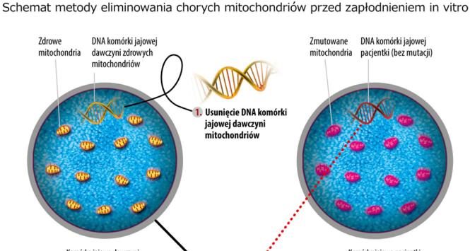 Schemat metody eliminowania chorych mitochondriów przed zapłodnieniem in vitro