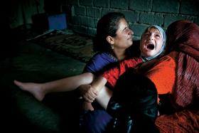 Irak, siedmioletnia dziewczynka poddawana klitoridektomii.