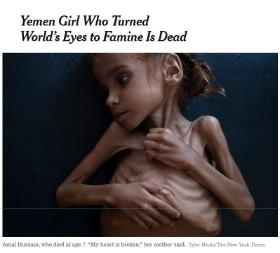 Amal, dziewczynka, która zwróciła uwagę na wojnę w Jemenie. Zmarła 26 października 2018 r.