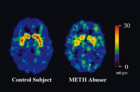 Skan receptorów dopaminy w mózgu - po prawej pod wpływem metamfetaminy.