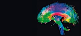Siatka połączeń mózgowych (DTI). Trójkolorowy skan mózgu (wykonany metodą MRI), obrazujący sieć połączeń w istocie białej.