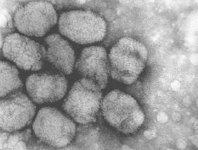 Wirus ospy prawdziwej (Variola vera)