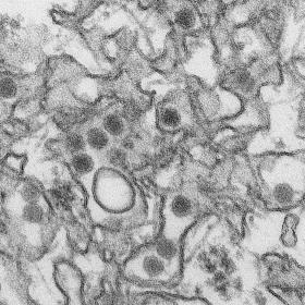 Wirus zika. Obraz z mikroskopu elektronowego.