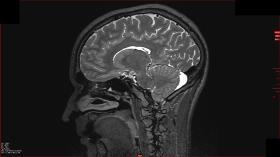 Ludzki mózg liczy ok. 86 mld neuronów i 100 bln synaps (miejsc, w których komórki nerwowe przekazują sobie informacje).