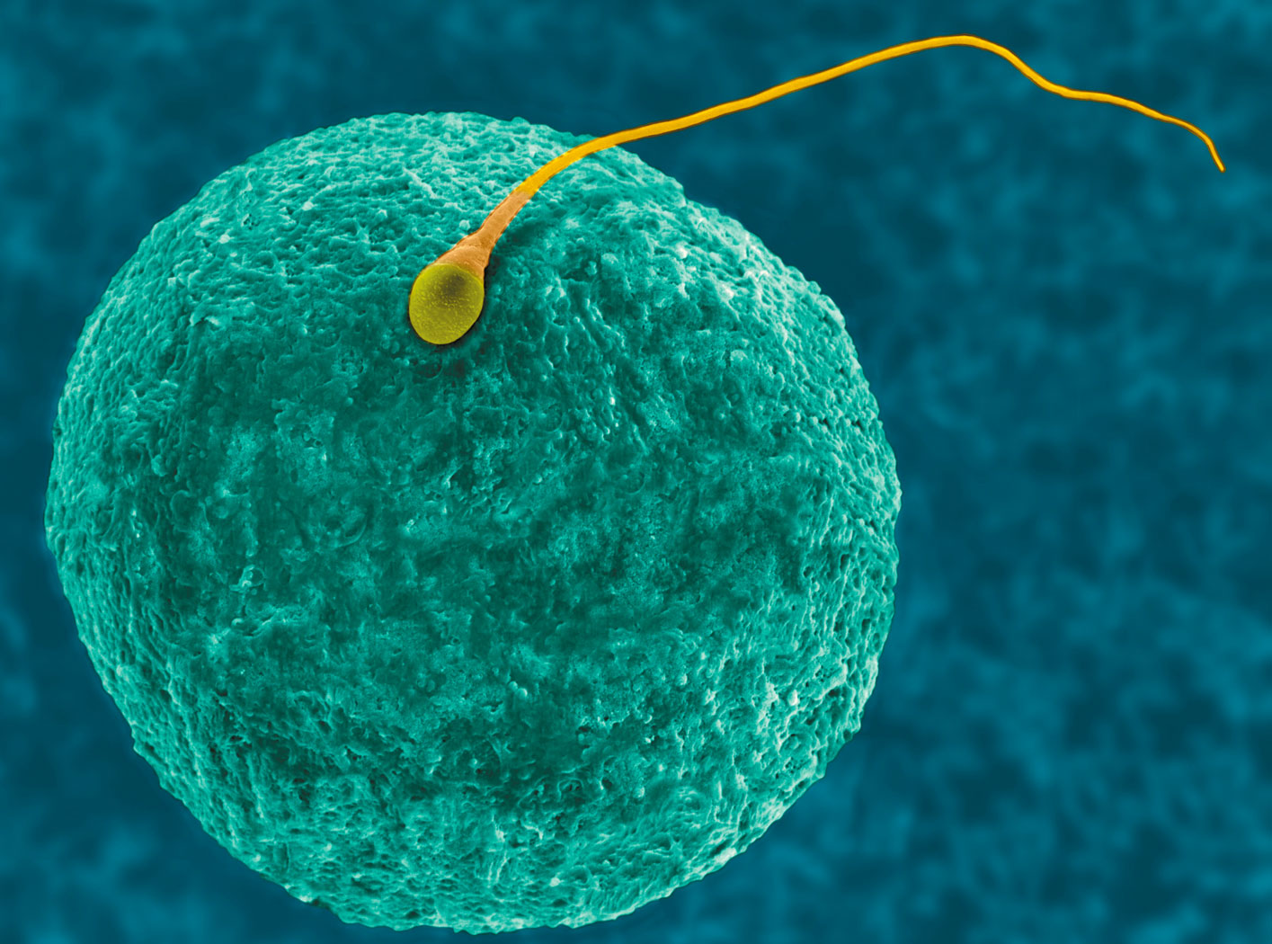 Męska antykoncepcja