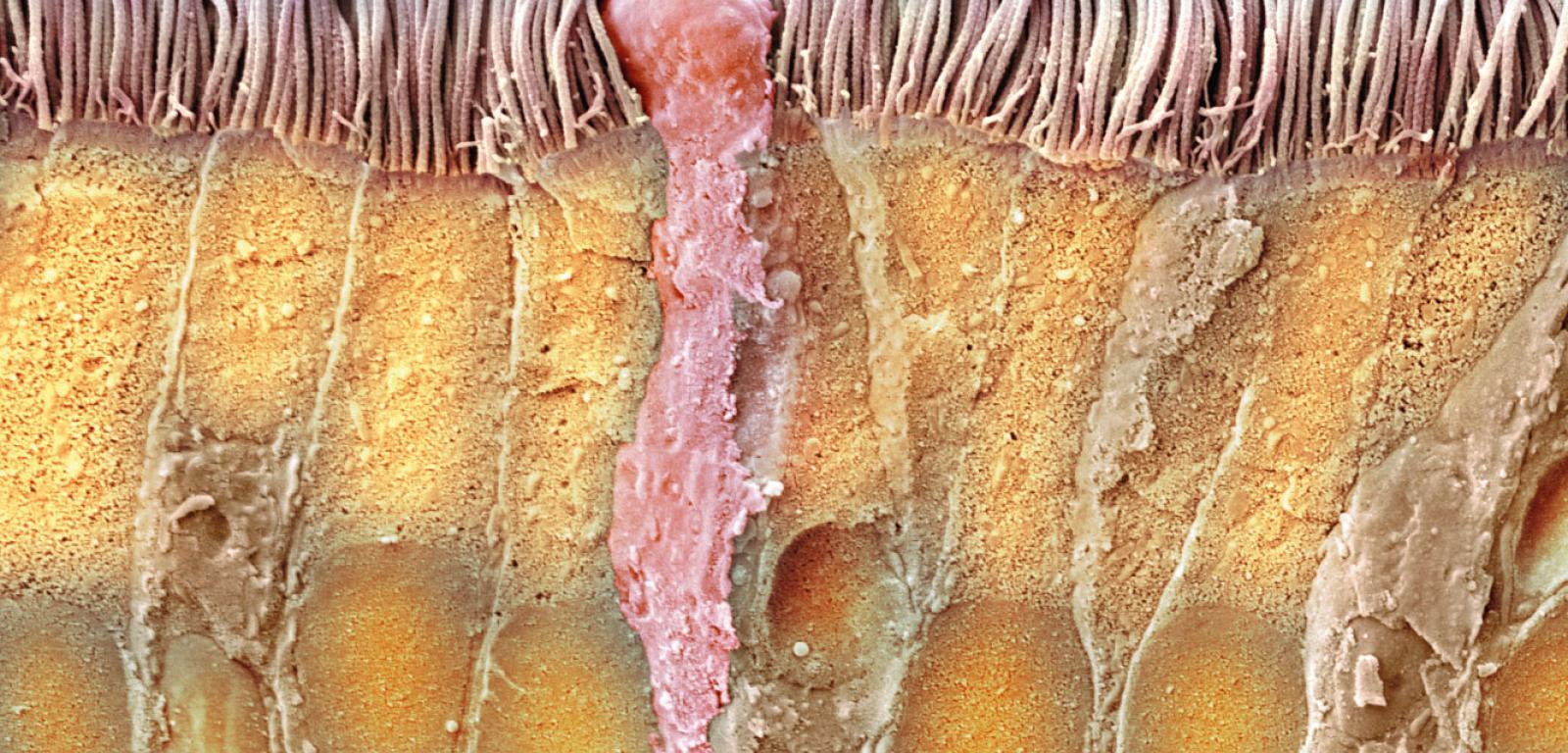 Przekrój przez ścianę tchawicy. Widać wydzielającą śluz komórkę (różowa) oraz rzęski oczyszczające i ogrzewające wdychane powietrze. Zdjęcie z elektronowego mikroskopu skaningowego.
