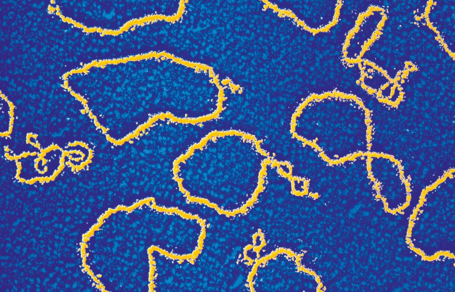 Plazmidy (na żółto). Zdjęcie spod mikroskopu elektronowego. Kolory nadane sztucznie
