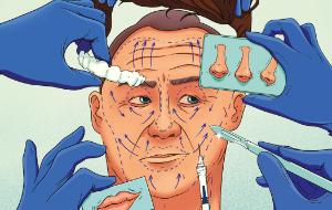 Lifting twarzy. Cena wyjściowa: od 28 tys. zł w górę w zależności od metody chirurga i kliniki może sięgnąć 100 tys. zł.