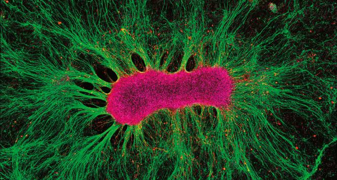 Organoid to skupisko żywych, funkcjonujących komórek właściwych dla danej tkanki i organizujących się tak jak ona.