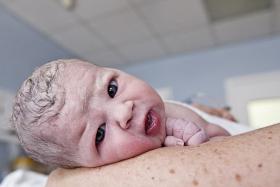 W ciągu ostatnich 13 lat liczba cesarskich cięć w Polsce się podwoiła. I stale rośnie.