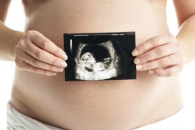 Liczba ciąż wspomaganych zapewne będzie rosła. Jeśli nie wejdą restrykcyjne przepisy, które to ograniczą.