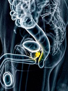 Rak prostaty rozwija się często bezobjawowo.