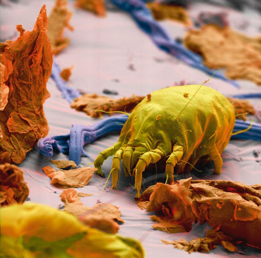 Skórożarłoczek skryty – foto­grafia spod mikroskopu skaningowego, kolory nadane sztucznie.