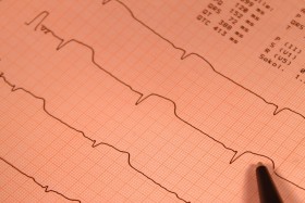 Sam mięsień sercowy wytrzyma nawet pół godziny bez ukrwienia. Podobnie wątroba i nerki.