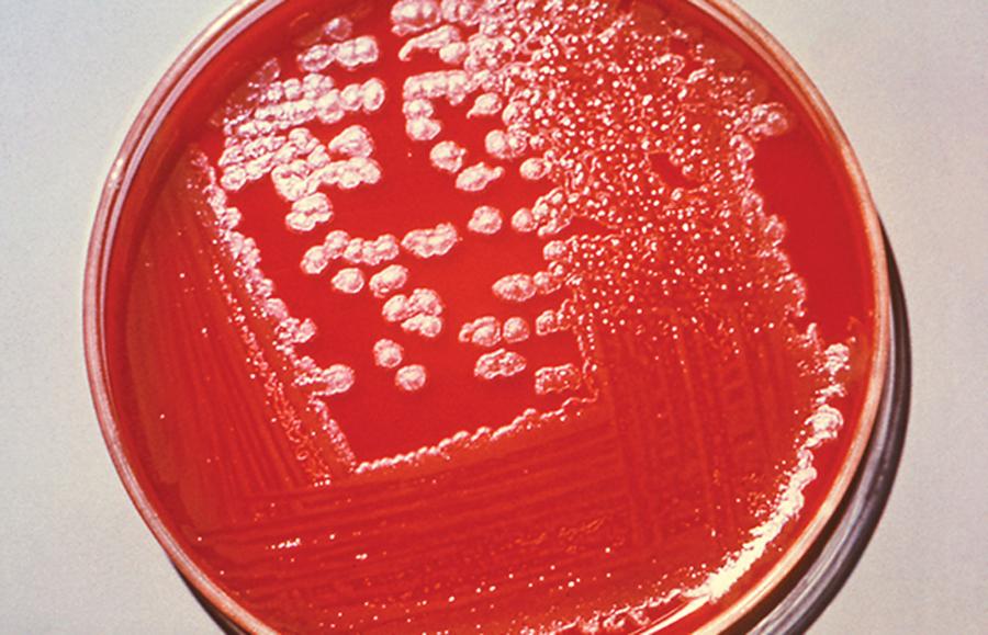 Zabójcze drobnoustroje: kolonie bakterii B. anthracis hodowane na pożywce na szalce.