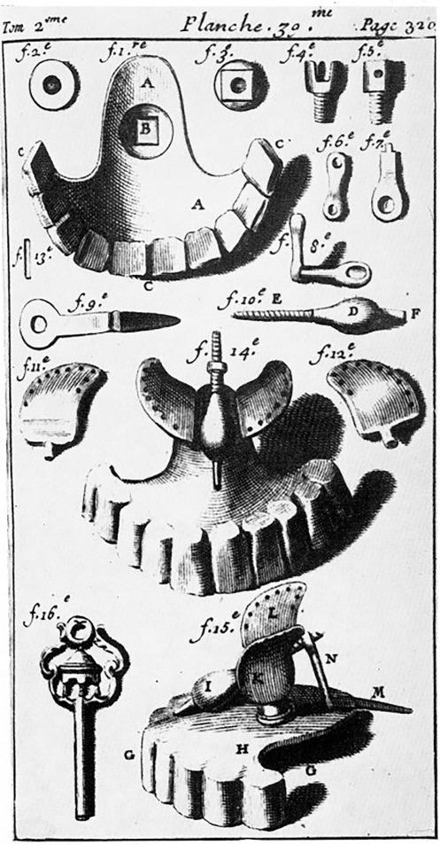 Obturator „skrzydlaty” P. Faucharda (1723) – różne części protezy i klucz do jej obsługi.