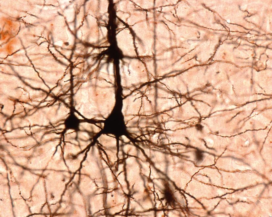 Neurony piramidowe kory mózgowej