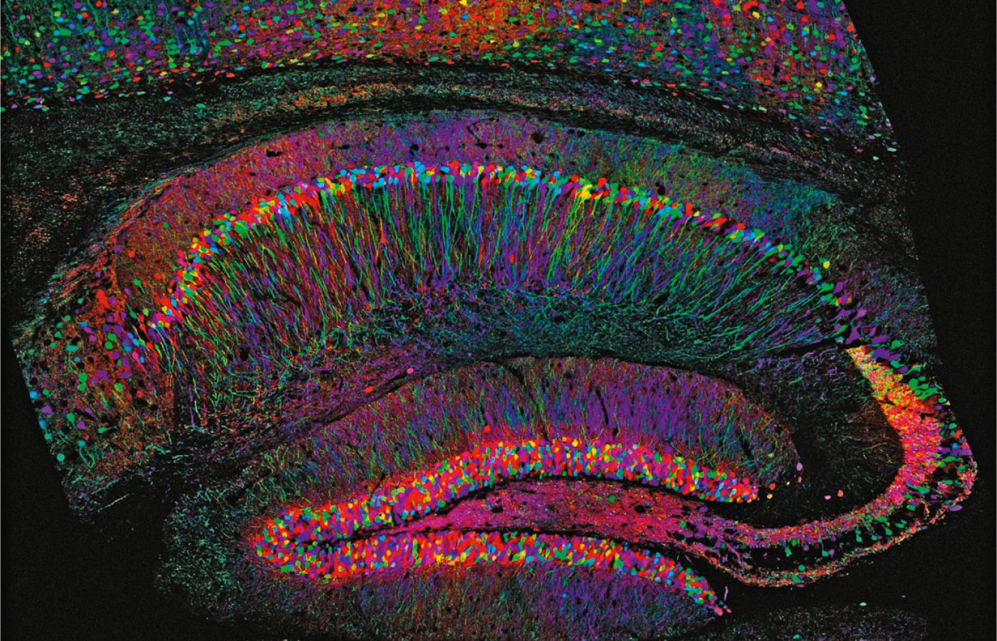 Zdjęcie hipokampu – struktury mózgu odgrywającej kluczową rolę w zapamiętywaniu i uczeniu się.