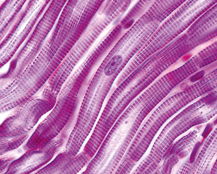 Prążkowane włókna mięśnia sercowego. Widoczne centralnie umieszczone jądra komórkowe.