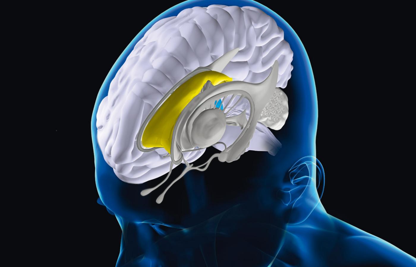 Obie półkule mózgu (tu widoczna prawa) łączy spoidło wielkie (zaznaczone kolorem żółtym), działające jak wielka infostrada.