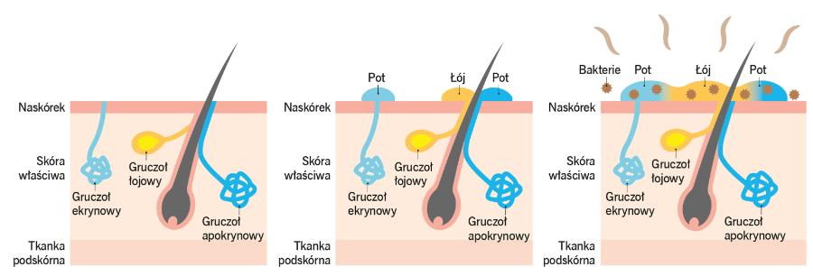 Wydzielina gruczołów stanowi świetną pożywkę dla ­bakterii. Ekrynowe wydzielają pot. Apokrynowe to np. gruczoły potowe wonne.