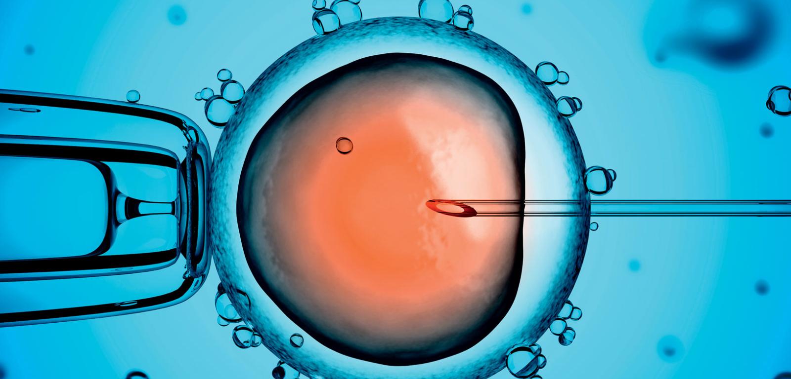 Rodzaj procedury in vitro. Wprowadzenie wyselekcjonowanego plemnika do cytoplazmy komórki jajowej.