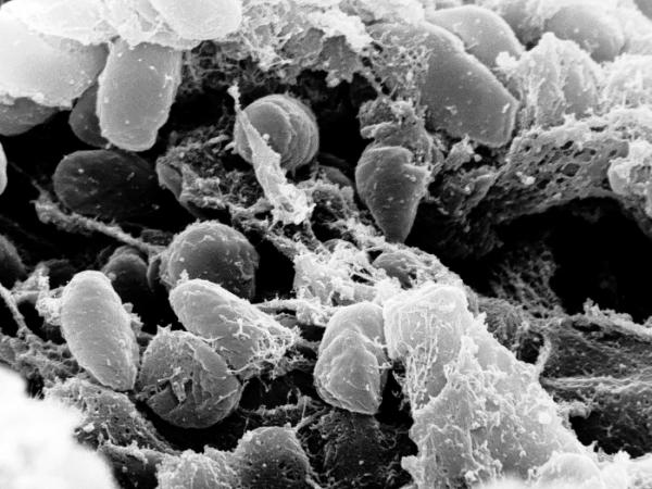 Pałeczka dżumy, Yersinia pestis