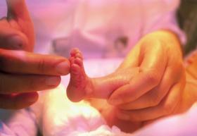 Rodzice znacznie częściej niż lekarze chcą ratować dziecko, uparcie wierząc w cud, który zresztą czasem się zdarza.