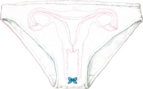 Trzy miesiące po operacji pacjentka powinna zacząć współżyć, w przeciwnym razie wytworzona pochwa się kurczy, zmniejsza.