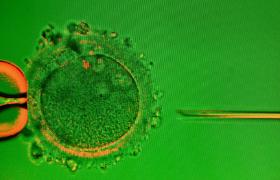 Łotwa przyciąga singielki na in vitro, niedostępne w Polsce dla samotnych kobiet i par jednopłciowych.