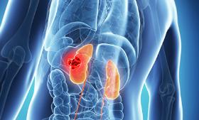 Leczenie nerek zaczyna się tak jak w chorobach serca – od zmiany diety.