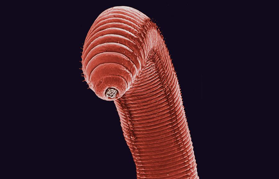 Odbyt dżdżownicy pospolitej (szary). Zdjęcie wykonano za pomocą mikroskopu elektronowego.