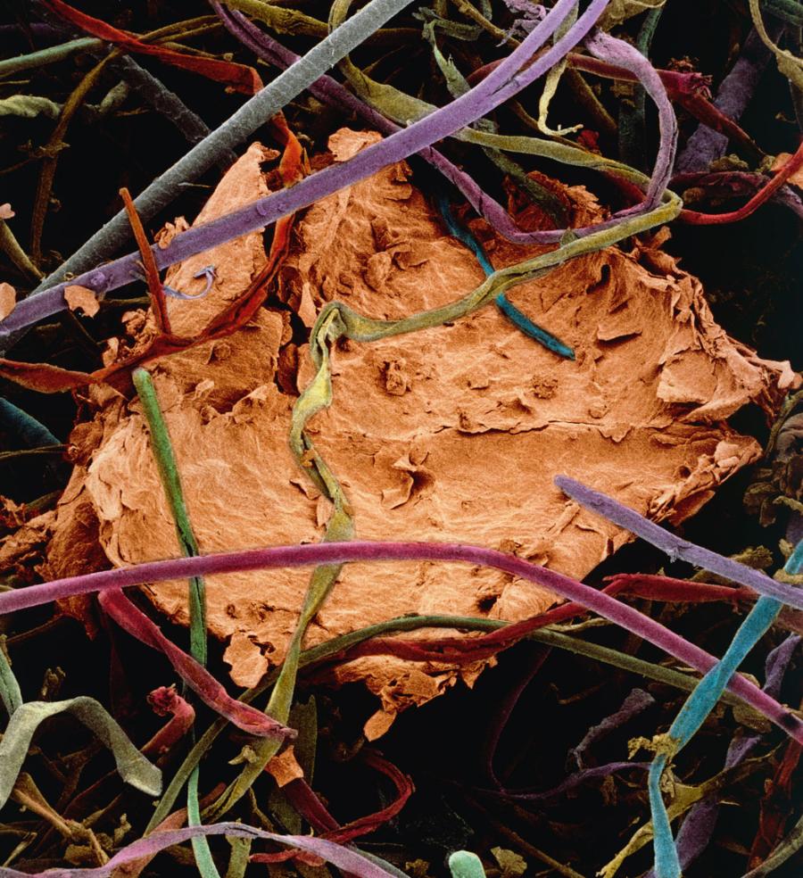 Fragment naskórka ludzkiego obecnego w kurzu – fotografia spod mikroskopu skaningowego.