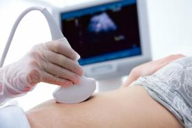 Jeśli we wczesnej ciąży boli brzuch, dobrze jest wykonać badanie USG w 6.-8. tygodniu.