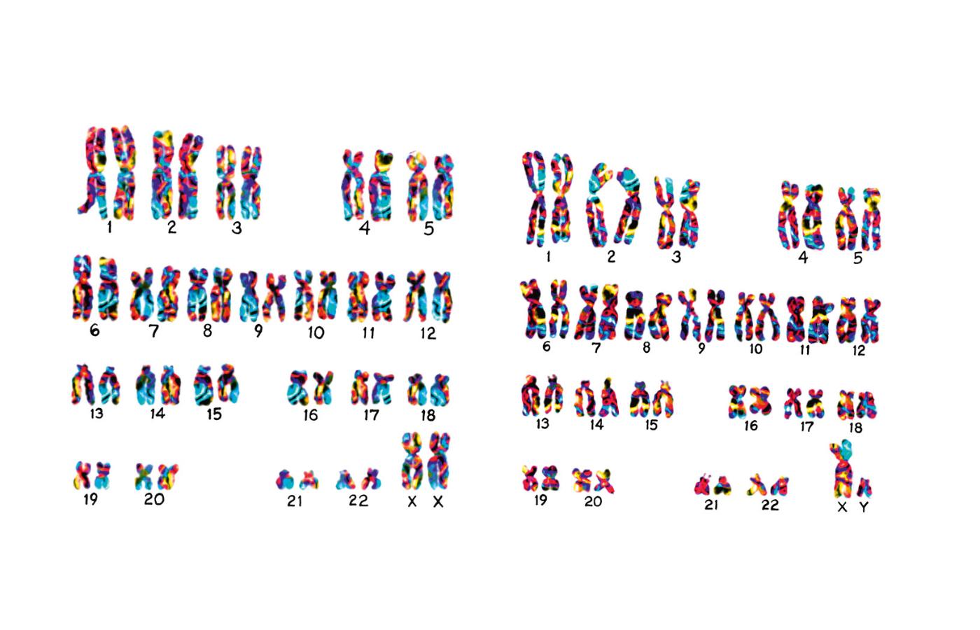 Kariotyp (kompletny zestaw chromosomów komórki somatycznej organizmu) kobiety (z lewej) i mężczyzny.