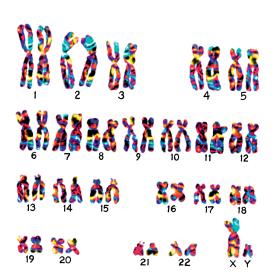 Zestaw chromosomów komórki somatycznej mężczyzny.