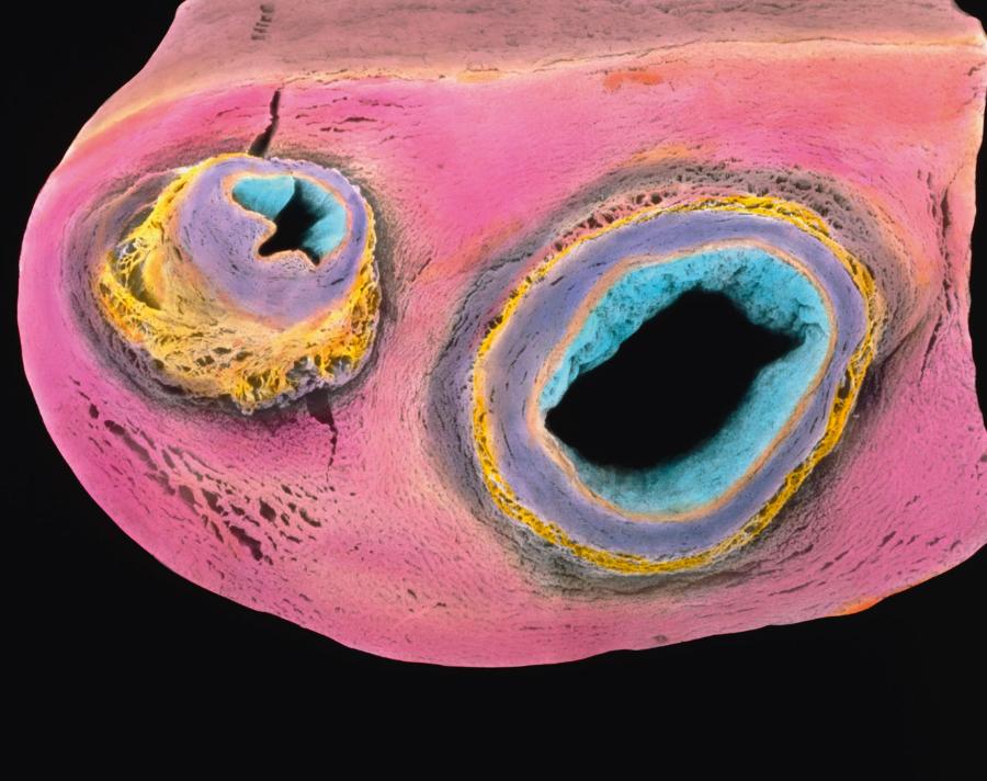 Pomiędzy naczyniami krwionośnymi (kolor niebieskofioletowy) sznura pępowinowego znajduje się galareta Whartona (różowy), będąca źródłem dorosłych komórek macierzystych. Kolory nadane sztucznie.