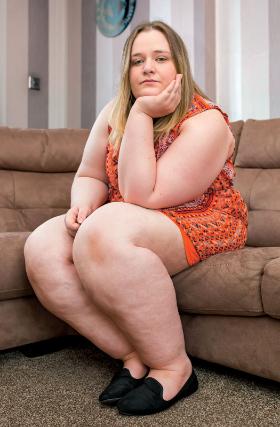 Wielu lekarzy nie potrafi rozpoznawać lipodemy, zaleca więc pacjentkom schudnięcie. Kiedy się to nie udaje, kobiety tracą chęć nawet do wychodzenia z domu. Na zdjęciu: 26-letnia Brytyjka Danielle Brown, którą zdiagnozowano dopiero po roku nieskutecznych ćwiczeń na siłowni i rygorystycznej diety.