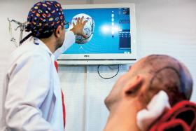 Podczas wizualizacji komputerowej można ustalić nową granice owłosienia.