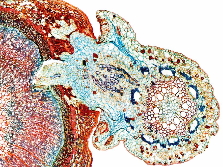 Widoczny pod mikroskopem przekrój przez roślinę (po lewej), do której tkanek wnika ssawka kanianki (po prawej).