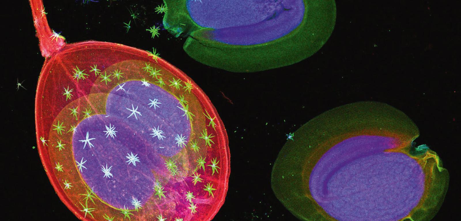 Obraz fluorescencji rentgenowskiej tkanek roślinnych, wskazujący na rozmieszczenie pierwiastków. Nasiona smagliczki Alyssum murale; nikiel jest tu niebieski.