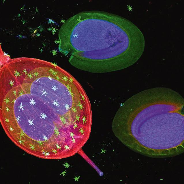 Obraz fluorescencji rentgenowskiej tkanek roślinnych, wskazujący na rozmieszczenie pierwiastków. Nasiona smagliczki Alyssum murale; nikiel jest tu niebieski.