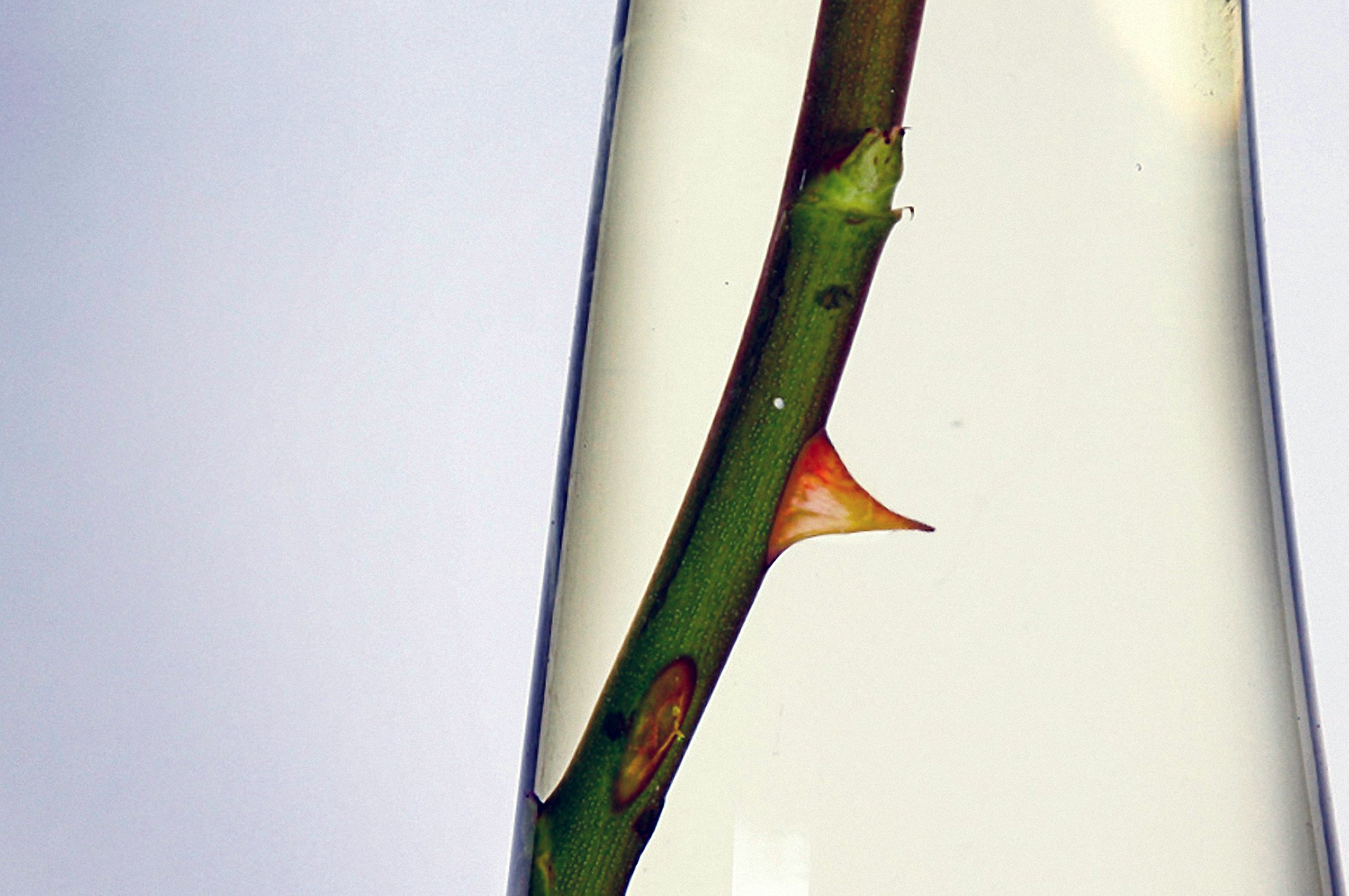 Ból: jakie ma znaczenie rozmowa neuronu z leukocytem