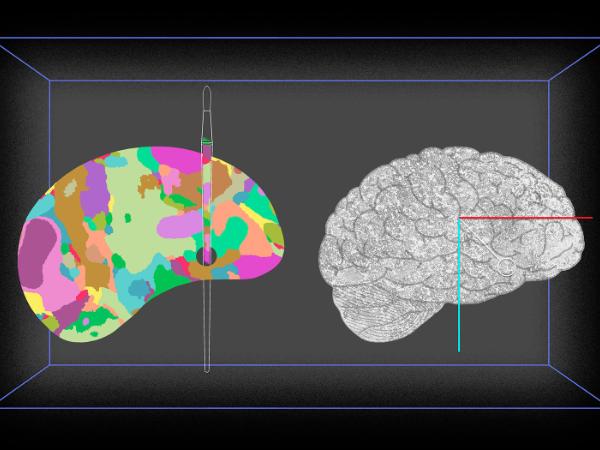 „Skupiam się na procesie zwanym segmentacją, czyli wykrywaniem konturów poszczególnych neuronów”.
