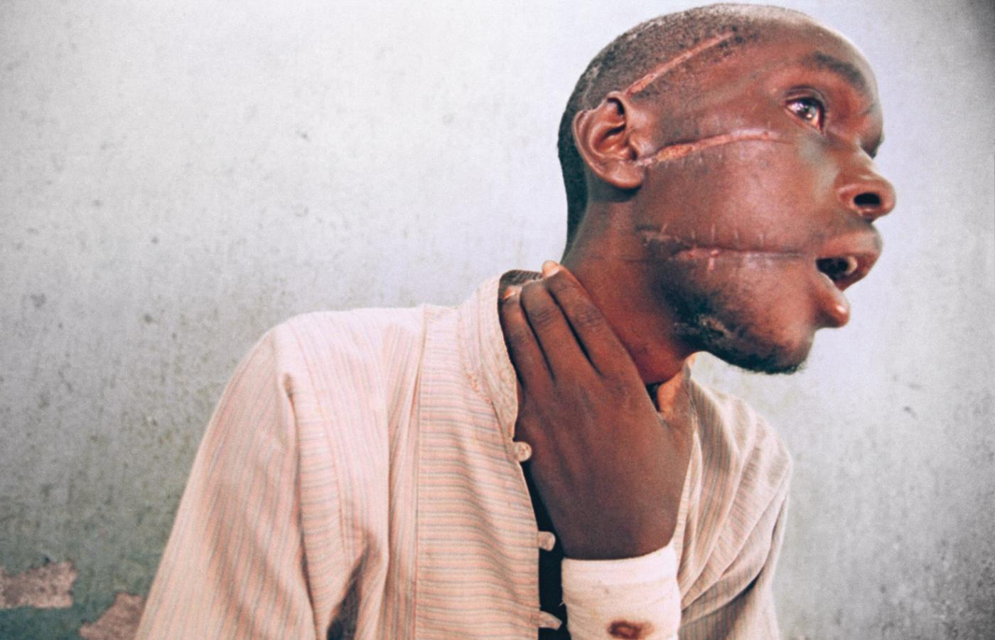 Mężczyzna okaleczony w czasie wojny domowej w Rwandzie.