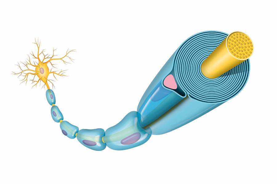 Komórki Schwanna (niebieski) budują tzw. osłonkę mielinową, która ochrania neuron (żółty). Najprawdopodobniej to ­właśnie z nich wywodzą się komórki DFTD.