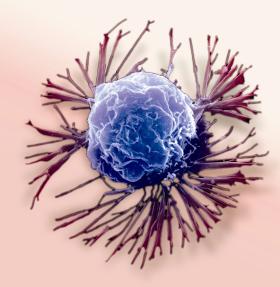 W ciągu ostatniej dekady choroba nowotworowa w wielu przypadkach ze śmiertelnej stała się przewlekłą.