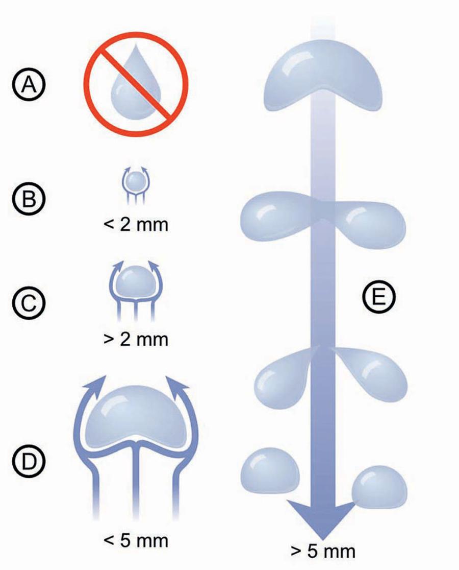 Krople deszczu nie wyglądają jak łzy (A). Kiedy są małe, mają kształt okrągły (B), a w miarę wzrostu stają się od spodu najpierw płaskie (C), a potem wklęsłe (D). Kiedy przekroczą rozmiary 5–6 mm, przeważnie zaczynają się rozpadać (E).