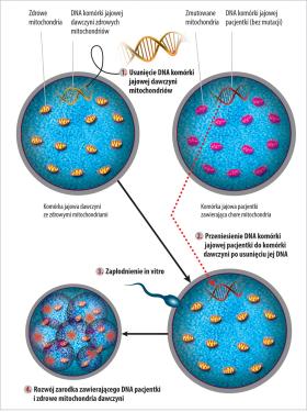Schemat ukazuje metodę przenoszenia matczynego genomu z jednej  niezapłodnionej komórki jajowej do innej, zdrowej, tak by pozbyć się chorych mitochondriów.