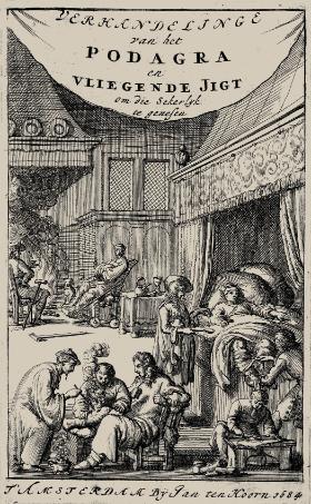 Leczenie podagry, rycina, 1684 r.